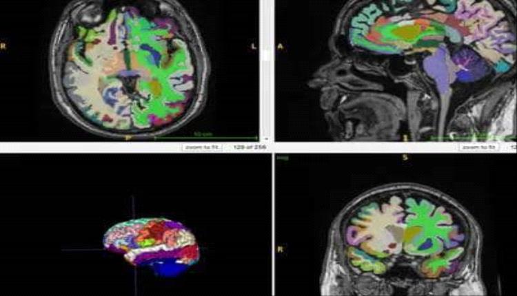 اكتشاف آلية جديدة لوصول الهرمونات إلى الدماغ