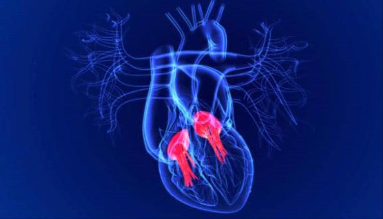 أطباء روس يطوّرون برنامجًا ذكيًا لإعادة بناء الصمام التاجي بدقة عالية