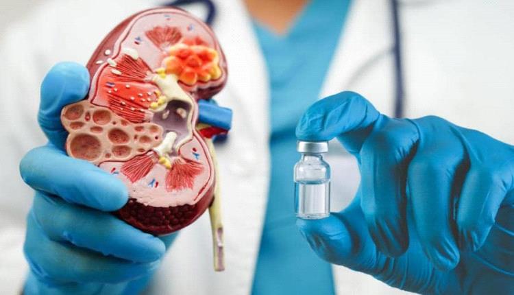 لقاح لسرطان الكلى يمنح الأمل للمرضى بعدم عودة المرض