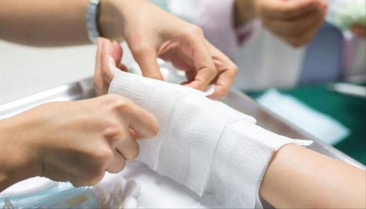 علماء يطورون دواء لتسريع التئام الجروح الناتجة عن الحروق