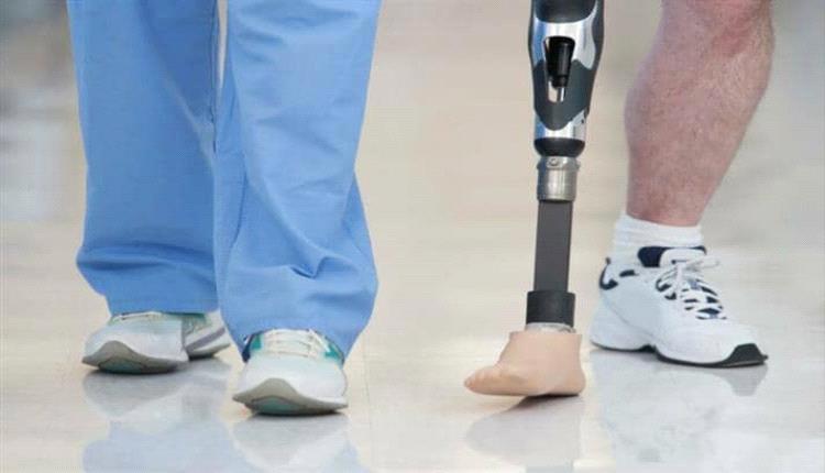 علماء يكتشفون آلية جينية تساعد على استعادة الأطراف المفقودة بالكامل