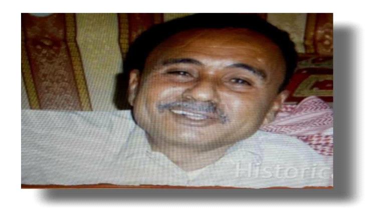 ​اهتمام رسمي بـ "قامات حضرموت": المحافظ بن ماضي يوجه بالرعاية العاجلة للأستاذ حسن كندسة العولقي