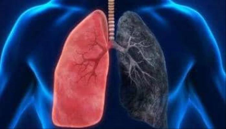 من مطبخك إلى رئتيك.. أطعمة ومشروبات طبيعية تساعد على تطهير الرئة من السموم