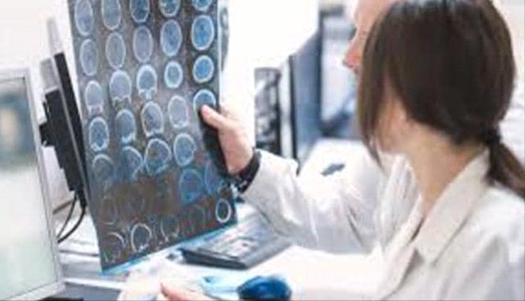 علماء روس يبتكرون نموذجًا حاسوبيًا لعلاج الصرع