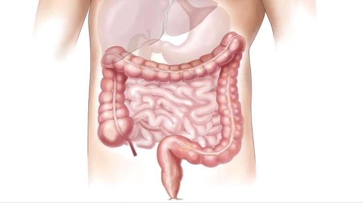 أطباء يوضحون: أطعمة تزيد أعراض القولون العصبي وأخرى تساعد على التخفيف