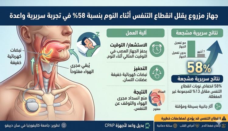 جهاز مزروع يقلل انقطاع التنفس أثناء النوم بنسبة 58% في تجربة سريرية واعدة