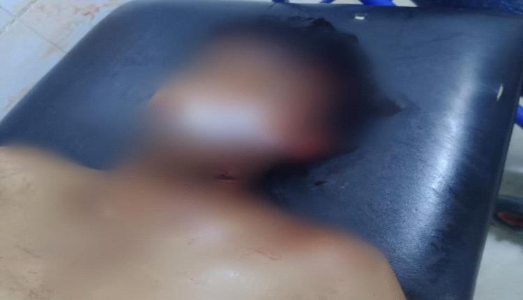 وفاة شاب في حادث دراجة نارية بمدينة زنجبار بمحافظة أبين