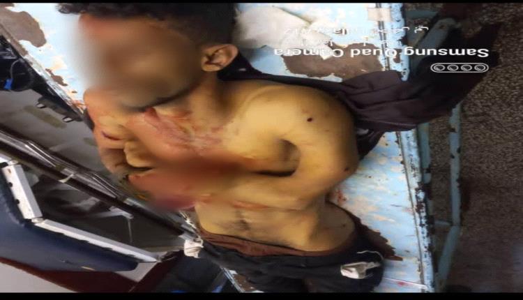 مقتل شاب على يد صديقه في محافظة الضالع