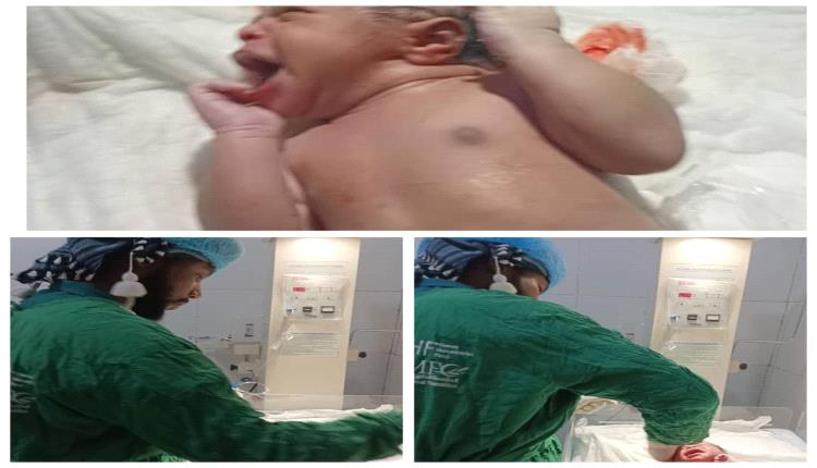 نجاح العملية القيصرية رقم 37 في مستشفى أحور العام