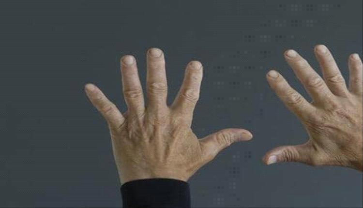 دراسة بريطانية تكشف علاقة بين طول أصابع المواليد وحجم أدمغتهم