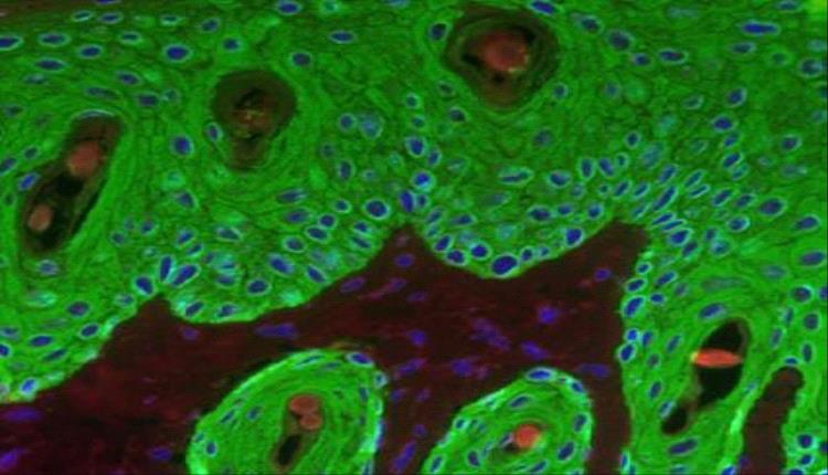 اليابان: تحويل خلايا الجلد إلى مستشعرات حيوية مضيئة لرصد الالتهابات