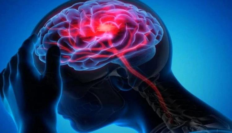 اكتشاف جديد في مايو كلينك: خريطة دماغية دقيقة تفتح آفاقاً لعلاج الصرع المستعصي