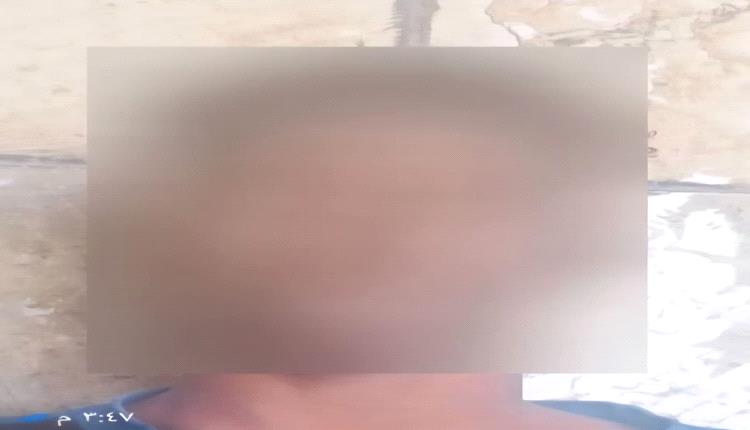 أمن العاصمة عدن يستعيد طفلًا وفتاتين مختطفين وضبط المتهم بالتنسيق مع الأمن الوطني في لحج.