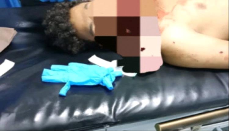 محافظ الضالع يوجه بسرعة القبض على المتهم بمقتل شخص في سوق سناح