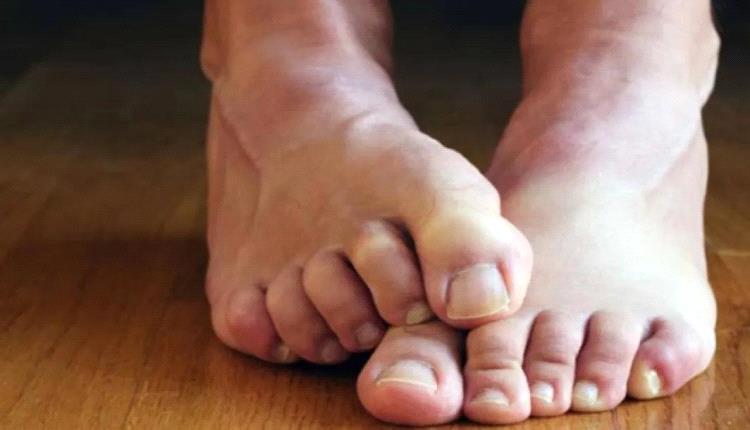 قدماك تكشف ما يخفيه الجسد: علامات مبكرة قد تنذر بأمراض خطيرة