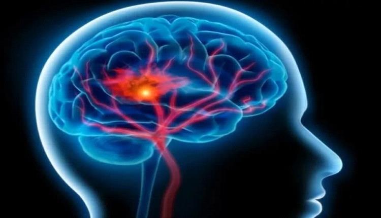 APOE2.. متغير جيني يسلّط الضوء على آليات جديدة لحماية الدماغ وتأخير الشيخوخة